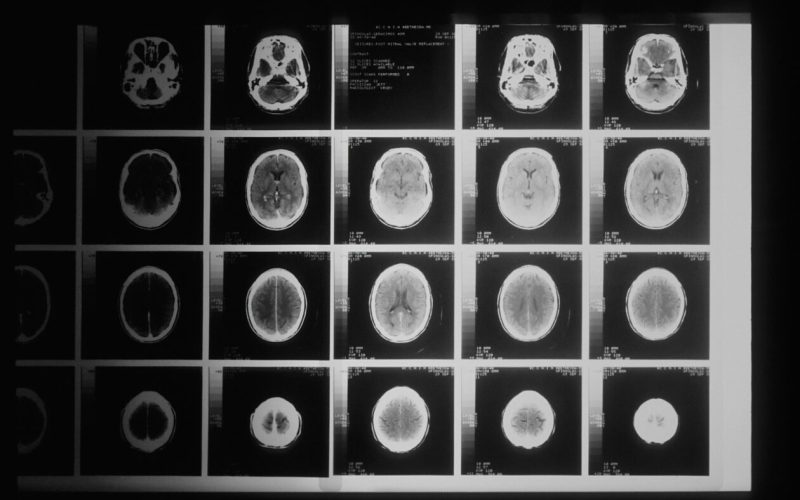 ai-vs.-mds:-microsoft-ai-tool-outperforms-doctors-in-diagnosing-complex-medical-cases